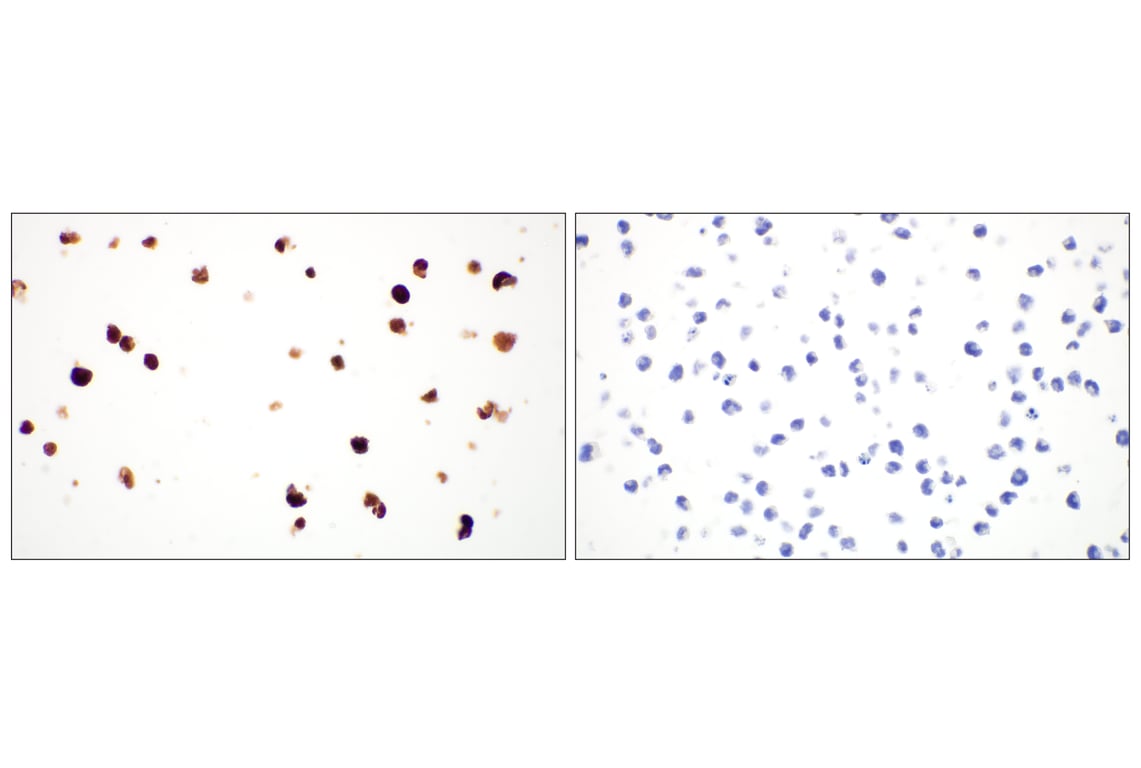 Immunohistochemistry Image 9: β3-Tubulin (E9F3E) Mouse mAb (BSA and Azide Free)