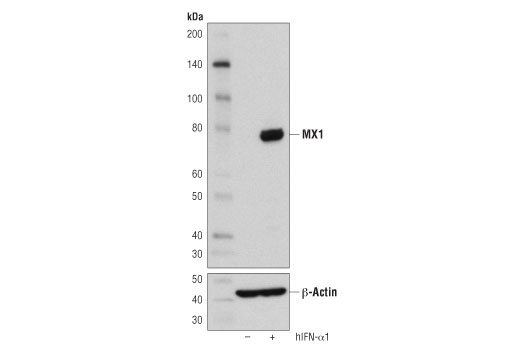 Western Blotting Image 1: MX1 (D3W7I) Rabbit mAb
