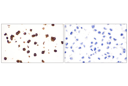 Immunohistochemistry Image 3: IL-2Rα/CD25 (E9W2J) XP<sup>®</sup> Rabbit mAb