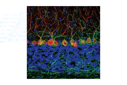 Immunofluorescence Image 1: Neurofilament-H (RMdO 20) Mouse mAb