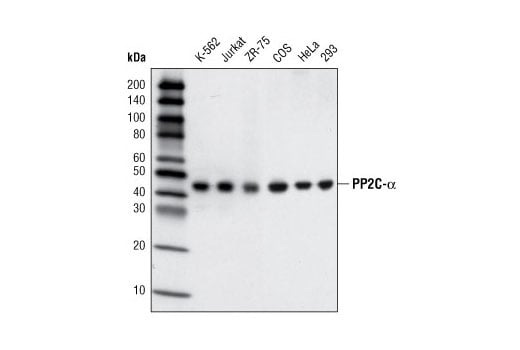 Western Blotting Image 1: PP2C-α (D18C10) XP<sup>®</sup> Rabbit mAb (BSA and Azide Free)