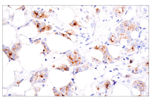 Immunohistochemistry Image 1: CD109 (E4I2V) Rabbit mAb