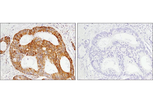 undefined Image 25: Glutamine Metabolism Antibody Sampler Kit