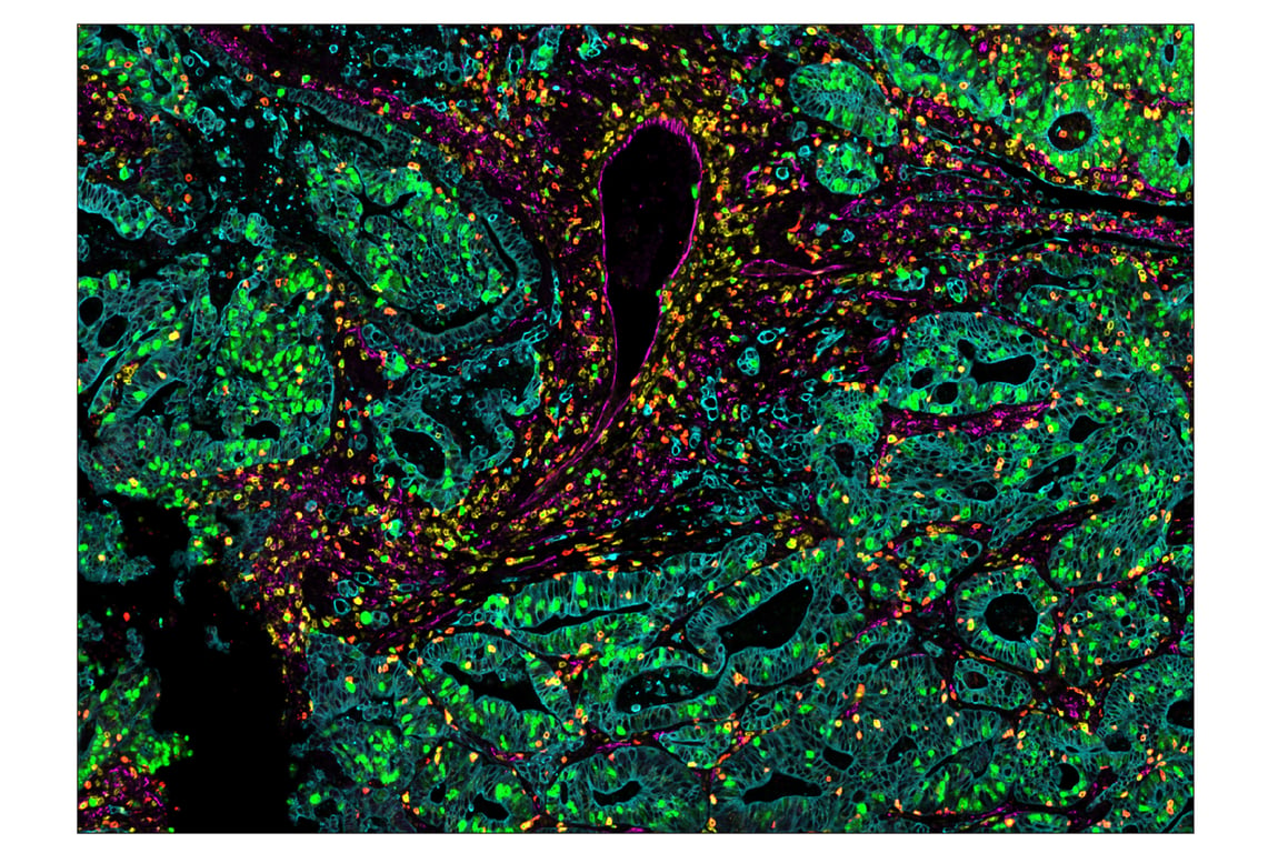 Immunohistochemistry Image 7: Ki-67 (8D5) & CO-0014-647 SignalStar<sup>™</sup> Oligo-Antibody Pair