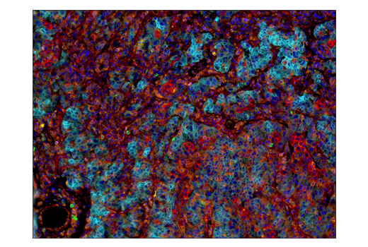 Immunohistochemistry Image 7: VISTA (D1L2G<sup>™</sup>) XP<sup>®</sup> Rabbit mAb (BSA and Azide Free)