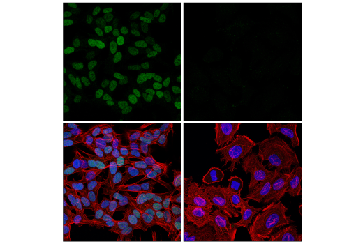 undefined Image 73: Epithelial-Mesenchymal Transition (EMT) IF Antibody Sampler Kit