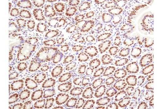 undefined Image 25: BAF Complex IHC Antibody Sampler Kit