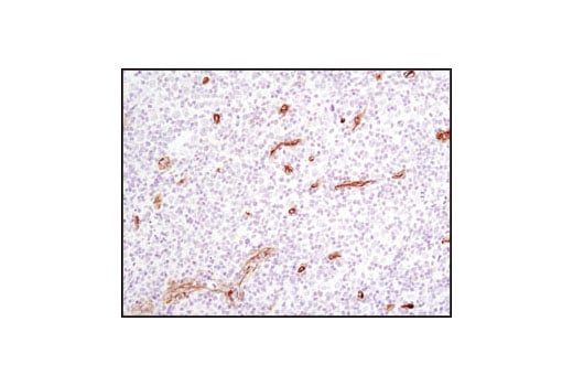 Immunohistochemistry Image 2: Caveolin-1 (D46G3) XP<sup>®</sup> Rabbit mAb