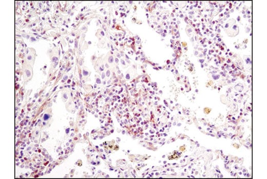 Immunohistochemistry Image 5: PLCγ1 (D9H10) XP<sup>®</sup> Rabbit mAb (BSA and Azide Free)