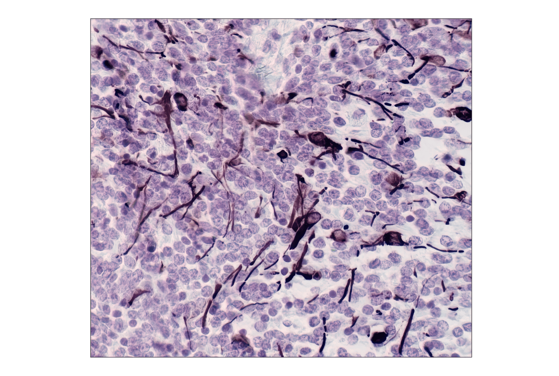 Immunohistochemistry Image 1: GFAP (GA5) Mouse mAb (BSA and Azide Free)