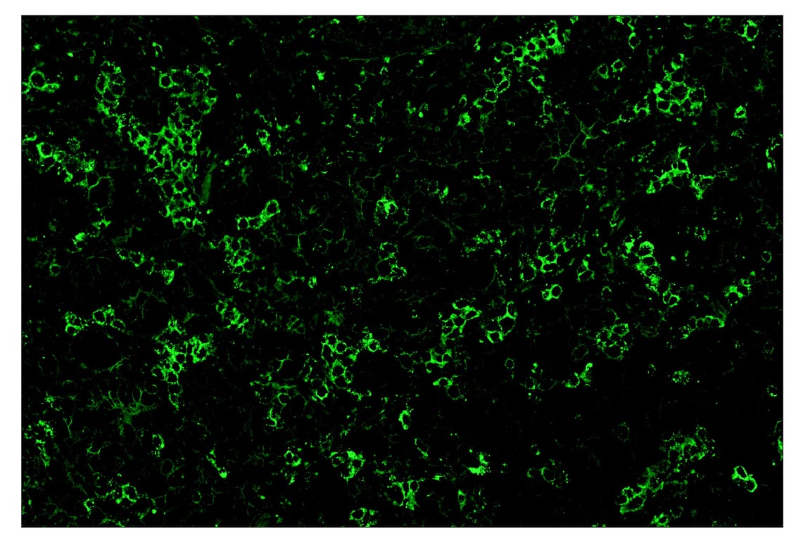 Immunohistochemistry Image 2: TIM-3 (D5D5R<sup>™</sup>) & CO-0010-750 SignalStar<sup>™</sup> Oligo-Antibody Pair