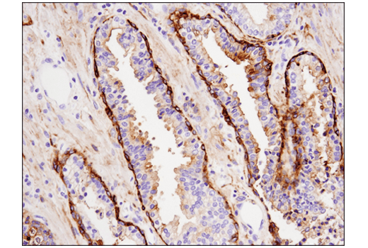 Immunohistochemistry Image 5: Tissue Factor/CD142 (E9M6T) XP<sup>®</sup> Rabbit mAb