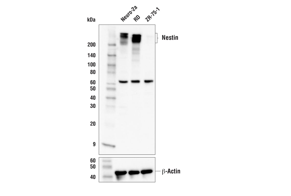 Western Blotting Image 1: Nestin Antibody