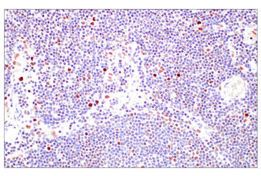 Immunohistochemistry Image 5: DNMT1 (D63A6) XP<sup>®</sup> Rabbit mAb (BSA and Azide Free)