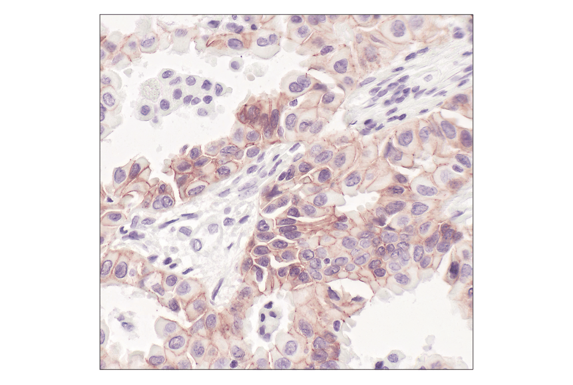 undefined Image 29: Cadherin-Catenin Antibody Sampler Kit
