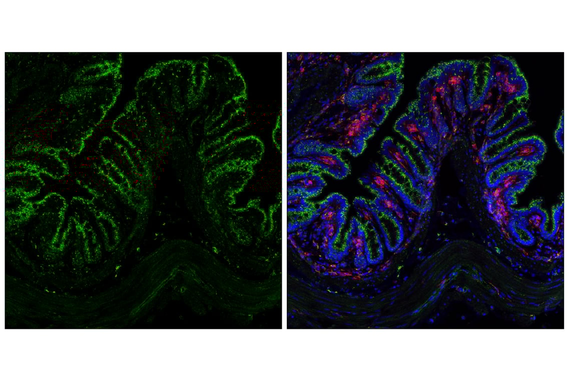 Immunofluorescence Image 3: Cathepsin D (E5V4H) Rabbit mAb