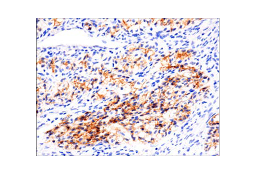 Immunohistochemistry Image 2: N-Cadherin (D4R1H) XP<sup>®</sup> Rabbit mAb