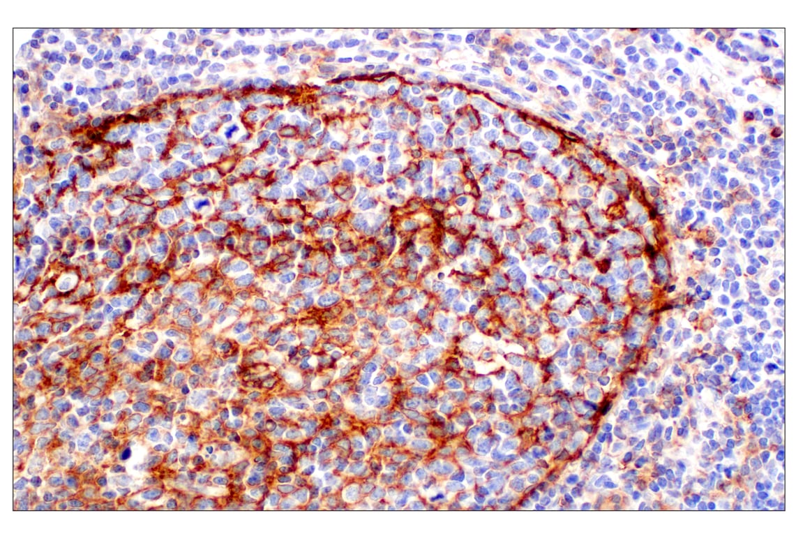Immunohistochemistry Image 11: CD11b/ITGAM (E3J2F) Rabbit mAb