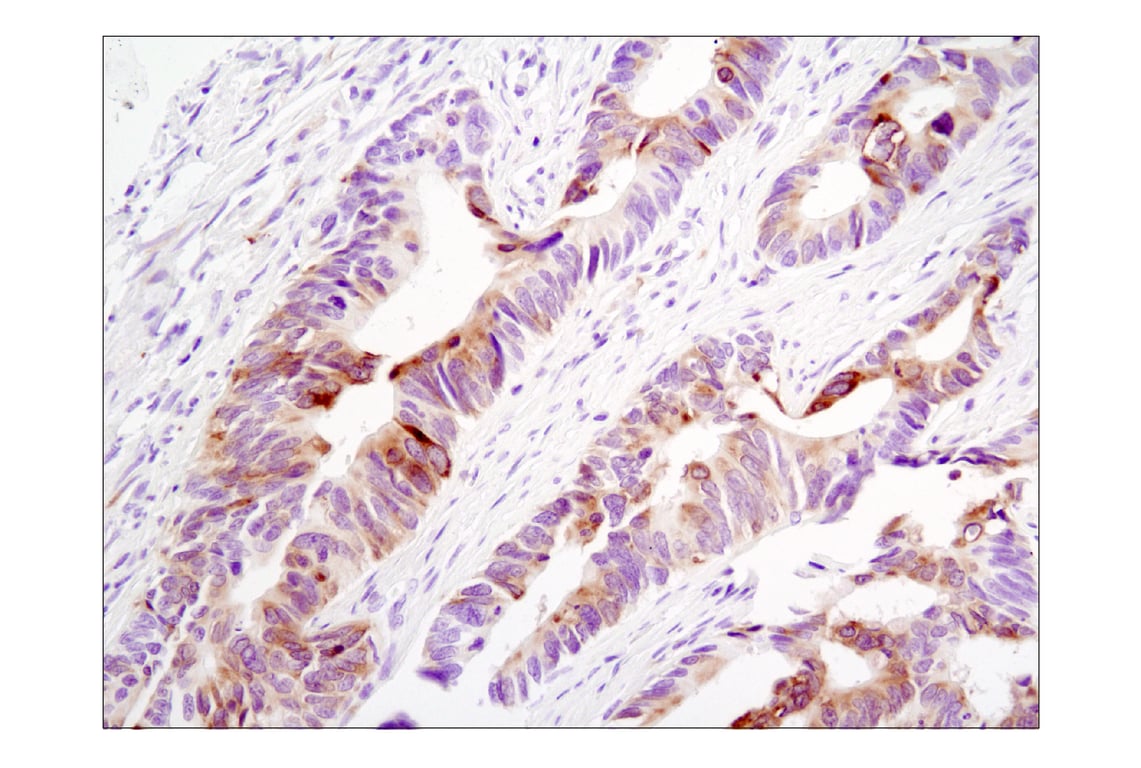 Immunohistochemistry Image 6: Phospho-S6 Ribosomal Protein (Ser235/236) (D57.2.2E) XP<sup>®</sup> Rabbit mAb (BSA and Azide Free)