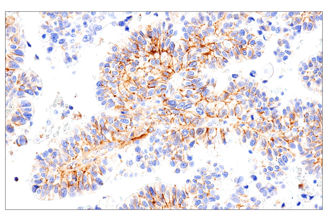 Immunohistochemistry Image 1: Syndecan 1 (E7F7T) Rabbit mAb