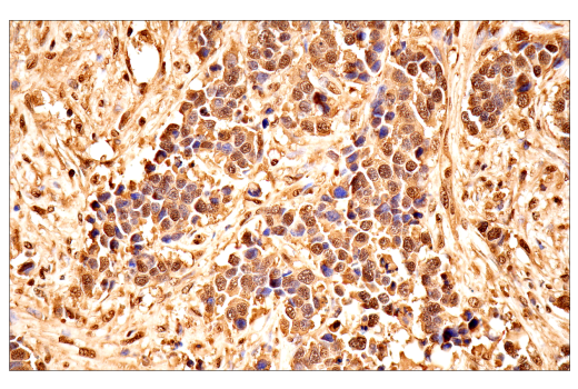 Immunohistochemistry Image 4: Ubiquitin (E6K4Y) XP<sup>®</sup> Rabbit mAb (BSA and Azide Free)