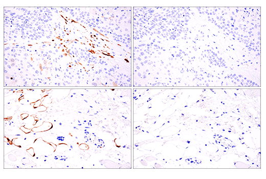 Immunohistochemistry Image 10: Calretinin (E7R6O) XP<sup>®</sup> Rabbit mAb