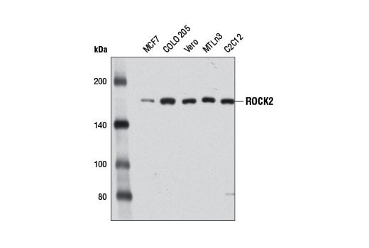 Western Blotting Image 1: ROCK2 (D1B1) Rabbit mAb