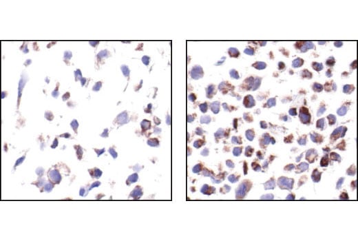 undefined Image 3: PhosphoPlus<sup>®</sup> Bad (Ser112) Antibody Duet