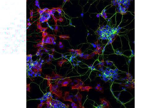 undefined Image 23: Demyelinating Disease Targets Antibody Sampler Kit