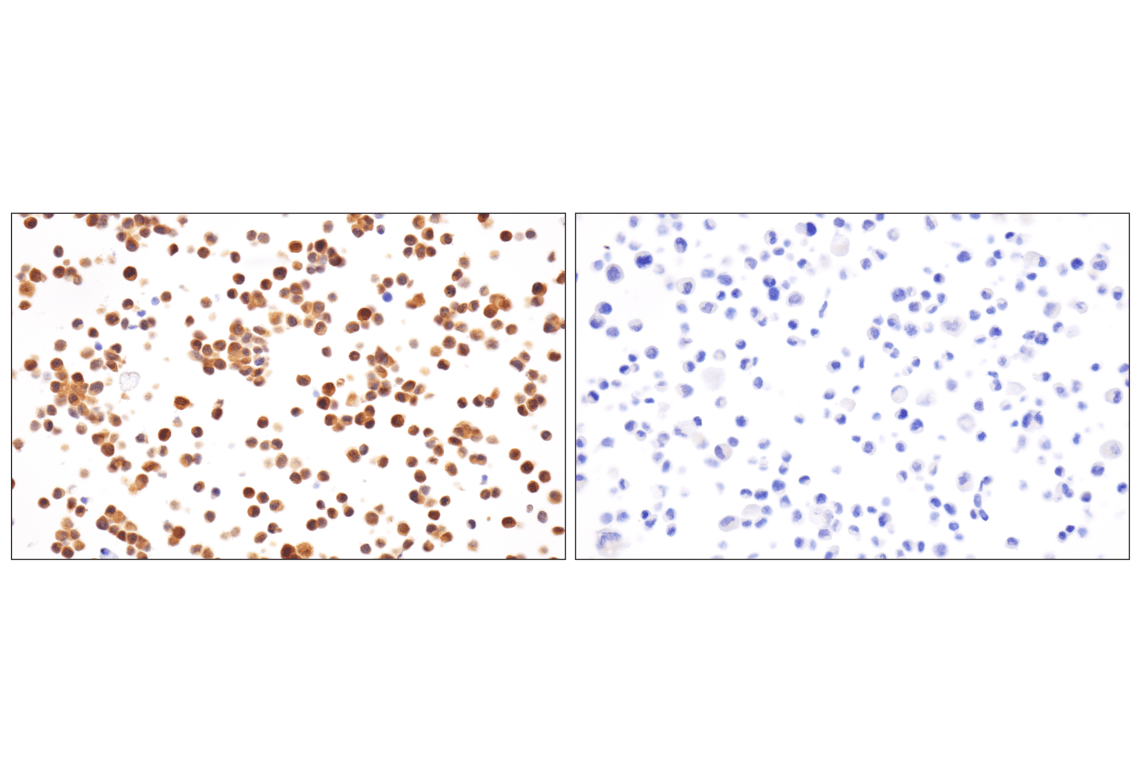 Immunohistochemistry Image 11: Caspase-8 (F5K9P) Rabbit mAb (BSA and Azide Free)