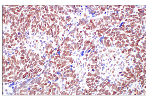 Immunohistochemistry Image 7: TIF1α/TRIM24 (E9T3N) Rabbit mAb