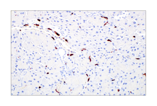 undefined Image 67: Mouse Reactive M1 vs M2 Macrophage IHC Antibody Sampler Kit