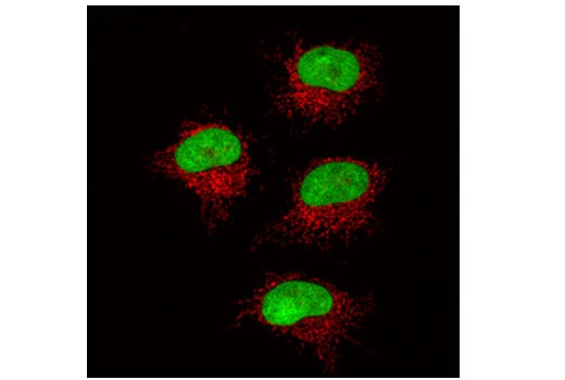 Immunofluorescence Image 1: Ubiquityl-Histone H2A (Lys119) (D27C4) XP<sup>®</sup> Rabbit mAb