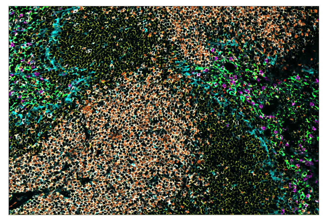 Immunohistochemistry Image 1: Granzyme B (E5V2L) & CO-0049-594 SignalStar™ Oligo-Antibody Pair