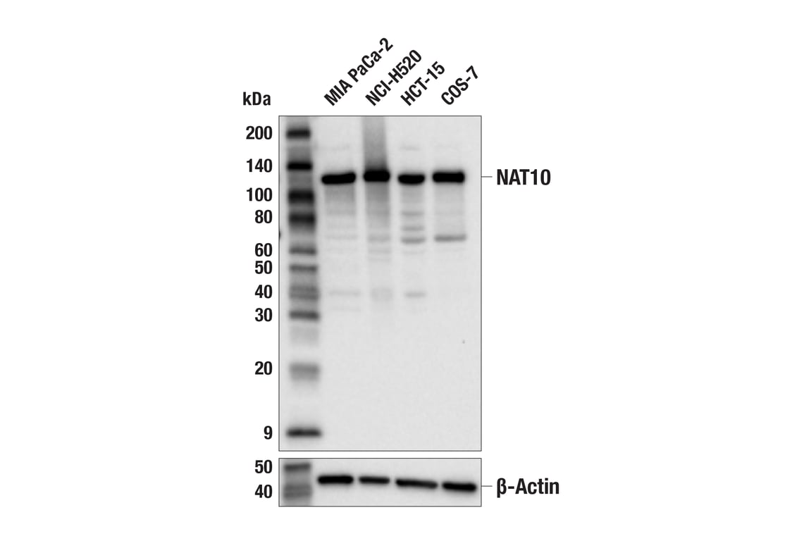 Western Blotting Image 1: NAT10 (E5U9W) Rabbit mAb