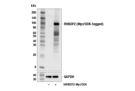 Western Blotting Image 2: RHBDF2 (E7U2K) Rabbit mAb