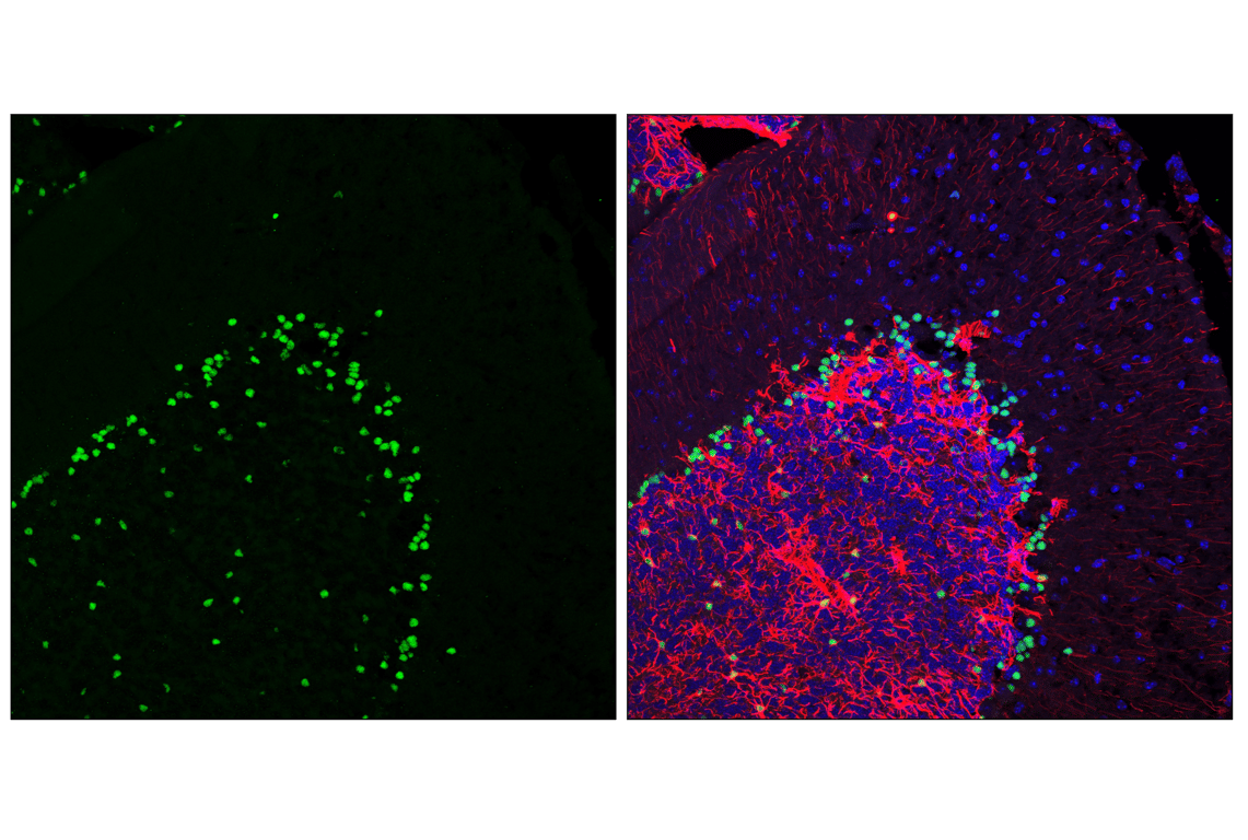 Immunofluorescence Image 1: Sox2 (E4I2X) Rabbit mAb