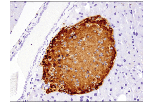 Immunohistochemistry Image 6: Synaptophysin (D8F6H) XP<sup>®</sup> Rabbit mAb (BSA and Azide Free)