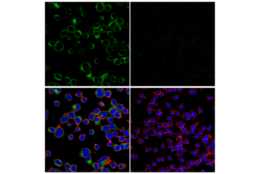 Immunofluorescence Image 1: BACE2 (E3Y9Q) Rabbit mAb