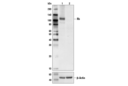 Western Blotting Image 1: Rb (4H1) Mouse mAb