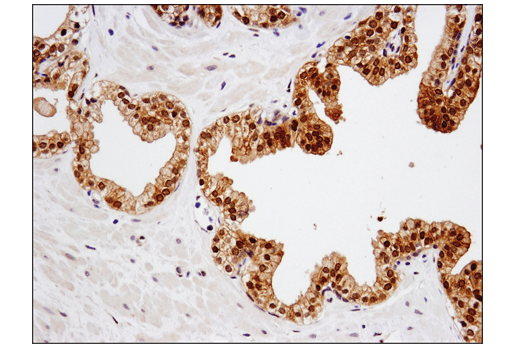 Immunohistochemistry Image 4: SMAD4 (D3R4N) XP<sup>®</sup> Rabbit mAb