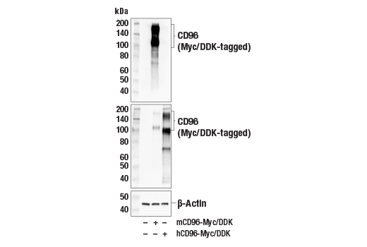 Western Blotting Image 2: CD96 (E1Y2Z) Rabbit mAb