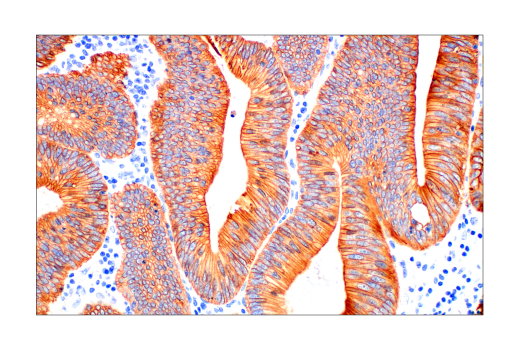 Immunohistochemistry Image 3: Pan-Keratin (AE1/AE3) Mouse mAb