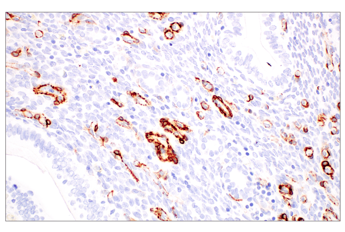 Immunohistochemistry Image 13: α-Smooth Muscle Actin (D4K9N) XP<sup>®</sup> Rabbit mAb (BSA and Azide Free)