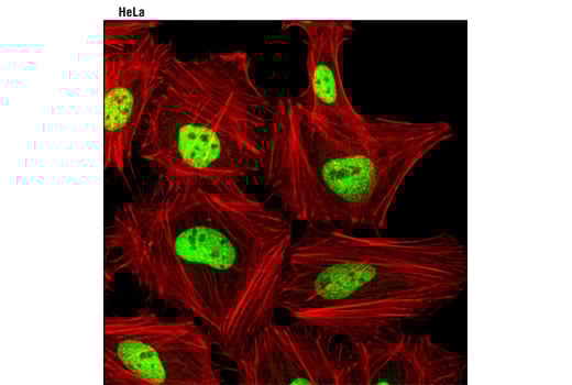Immunofluorescence Image 1: JunD (D17G2) Rabbit mAb