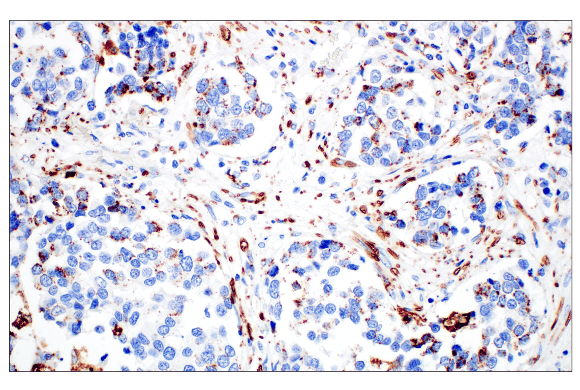 Immunohistochemistry Image 3: Perilipin-2 (E6G6M) Rabbit mAb