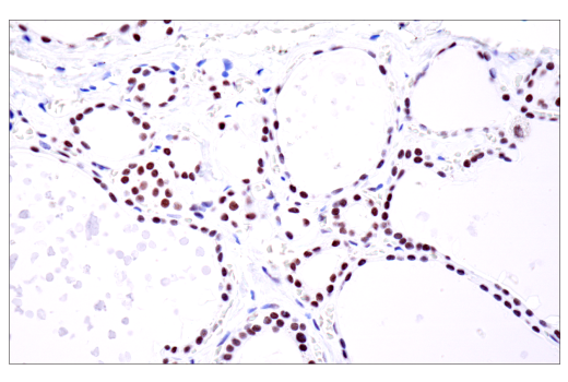 undefined Image 76: BAF Complex IHC Antibody Sampler Kit