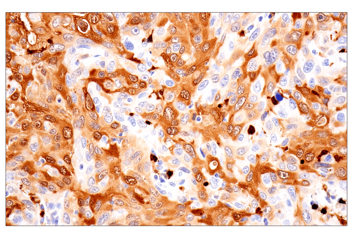 Immunohistochemistry Image 1: S100A8 (F4R2W) Rabbit mAb (BSA and Azide Free)