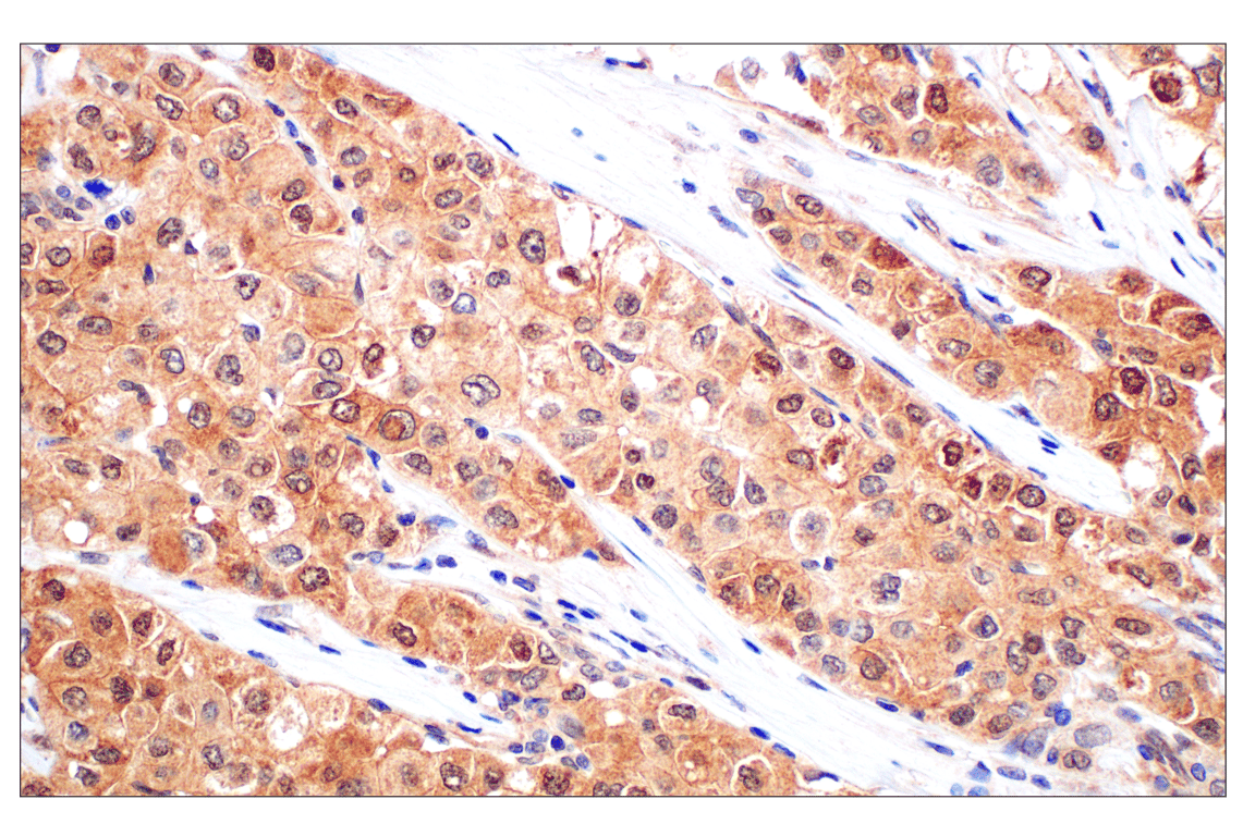 Immunohistochemistry Image 3: Stat3 (124H6) Mouse mAb