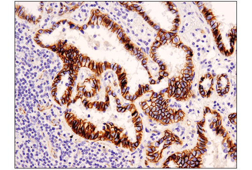 Immunohistochemistry Image 1: Catenin δ-1 (D7S2M) XP<sup>®</sup> Rabbit mAb